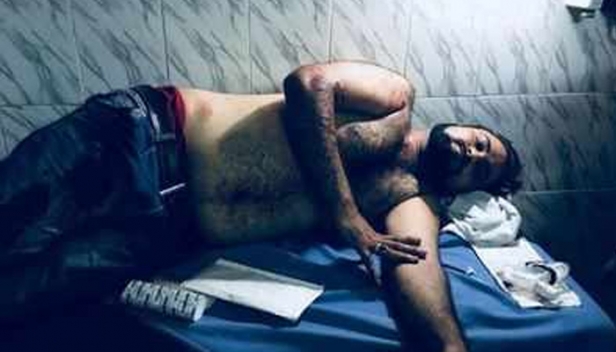 നുണ പ്രചരിപ്പിച്ചും ജയിലിൽ അടച്ചും അപമാനിച്ചിട്ടും അവർക്ക് മതിയായില്ല; ഡോക്ടർ കഫീൽഖാന്റെ സഹോദരനെ വെടിവെച്ച് വീഴ്ത്തി കലാപക്കാർ: ഗൊരഖ്പൂർ ശിശുമരണത്തിന്റെ ദുരന്തം ലോകത്തോട് പറഞ്ഞ ഡോക്ടർ കഫീൽ ഖാനെ വിടാതെ പിന്തുടർന്ന് ആരോ ചിലർ