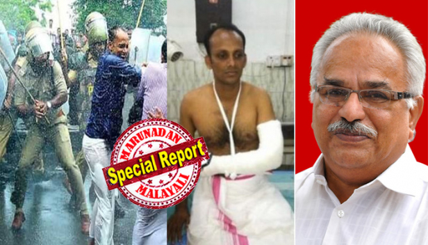 കാനം രാജേന്ദ്രന് ഇത് എന്തുപറ്റി? സ്വന്തം എംഎൽഎയെ തല്ലി കൈയൊടിച്ചിട്ടും പൊലീസിനെതിരെ വിമർശനമില്ല; വീട്ടിലിരുന്നിട്ടല്ല സമരത്തിന് പോയിട്ടാണ് എംഎൽഎയെ പൊലീസ് മർദ്ദിച്ചതെന്ന് കാനം; അനീതിയെ എതിർക്കുന്നതിനിടെ പൊലീസ് നടപടി നേരിടേണ്ടി വരും; മാധ്യമങ്ങളുടെ ട്യൂണിന് അനുസരിച്ച് തുള്ളുന്ന പാർട്ടിയല്ല സിപിഐ എന്നും സംസ്ഥാന സെക്രട്ടറി; തൊട്ടതിനും പിടിച്ചതിനും സിപിഎമ്മിനെ എതിർത്തിരുന്ന കാനത്തിന്റെ ഇപ്പോഴത്തെ മൗനം ദുരൂഹമെന്ന് അണികൾ