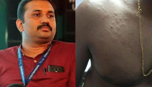 'നിനക്ക് ഒരു കുരുവുമില്ലെ'ന്ന് എസ്ഐ പറഞ്ഞത് അലർജികാരണം ആശുപത്രിയിലേക്ക് പോയ ആളോട്; ഡിക്ലറേഷൻ ഫോം കാണിച്ചിട്ടും രോഗിയെ തിരിച്ചയച്ചത് ആരോഗ്യ പ്രവർത്തകരുടെ സാന്നിധ്യത്തിലും; കൊറോണയേക്കാൾ ഭീകരരാവരുത് പൊലീസുകാരെന്നും ഡോ. മനോജ് വെള്ളനാട്
