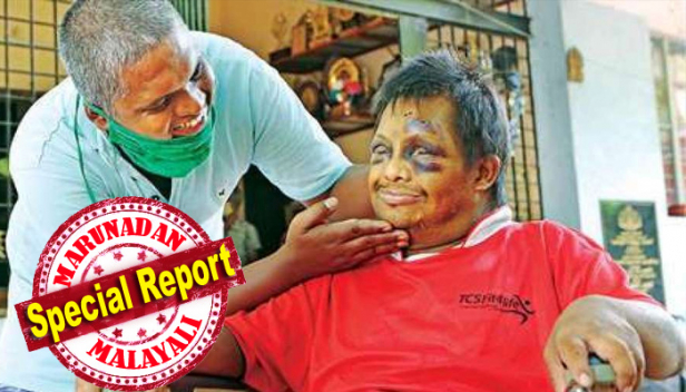കണ്ണിന് പൂർണ്ണമായും കാഴ്ചയില്ല; തനിയെ ഭക്ഷണം കഴിക്കാനോ കുളിക്കാനോപോലും അറിയില്ല; കാലിന് സ്വാധീനക്കുറവുള്ളതിനാൽ ടോയ്ലറ്റിൽ പോകാൻ രണ്ടു പേരുടെ സഹായം വേണം: തെരുവോരം മുരുകന്റെ സംരക്ഷണയിൽ കഴിയുന്ന ഡേവിഡ് ജീവിക്കുന്നത് ബന്ധുക്കൾ തേടി വരുമെന്ന പ്രതീക്ഷയിൽ