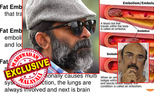 ശസ്ത്രക്രിയയെ തുടർന്നുള്ള സച്ചിയുടെ മരണത്തിനു പിന്നിൽ ഫാറ്റ് എംബോളിസമോ? ബോണിൽ നിന്നുള്ള ഫാറ്റ് ഇളകി ഹൃദയത്തിൽ എത്തിയുള്ള കാർഡിയാക് അറസ്റ്റ് ആണോ സച്ചിക്ക് വന്നത്? ശസ്ത്രക്രിയയ്ക്ക് ശേഷം ബോധം തെളിയുകയും സംസാരിക്കുകയും ചെയ്തത് ഇതിനു തെളിവെന്നു ആരോഗ്യ വിദഗ്ദർ; മരണം ചികിത്സയിലെ കൈപ്പിഴ കാരണം; ജഗതിക്ക് സംഭവിച്ചത് ഇതേ അവസ്ഥ; അനസ്തീഷ്യാ പിഴവ് കാരണം എറണാകുളത്തെ തിയേറ്റർ ഉടമ സ്ട്രോക്ക് വന്നു കിടക്കുന്നെന്ന് ലിബർട്ടി ബഷീർ; മലയാള സിനിമയിലെ ഹിറ്റ്മേക്കറുടെ അന്ത്യം വിവാദത്തിലേക്കോ?