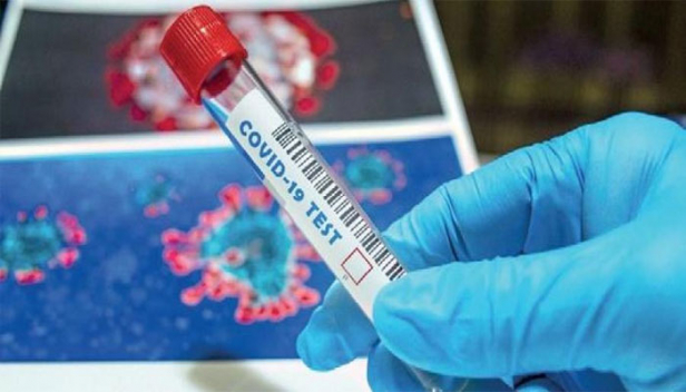 എറണാകുളം ജില്ലയിൽ രോഗലക്ഷണങ്ങൾ ഇല്ലാത്ത കോവിഡ് രോഗികൾക്കായി സജ്ജമായത് 8694 കിടക്കകൾ; വിവിധ തദ്ദേശ സ്വയം ഭരണ സ്ഥാപനങ്ങളിലായി ക്രമീകരിച്ചിട്ടുള്ളത് 141 കേന്ദ്രങ്ങൾ